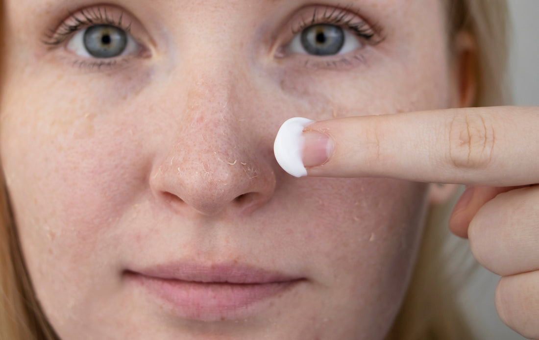 Winterproof your skin