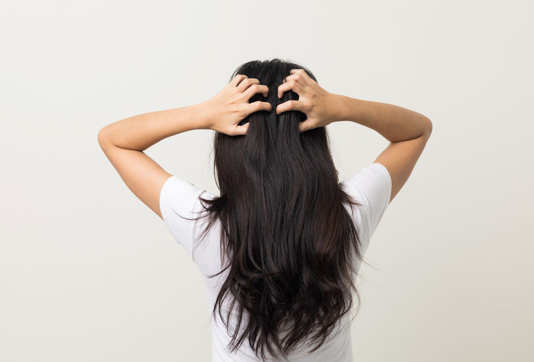 Itchy scalp, scalp condition, hair, trichology