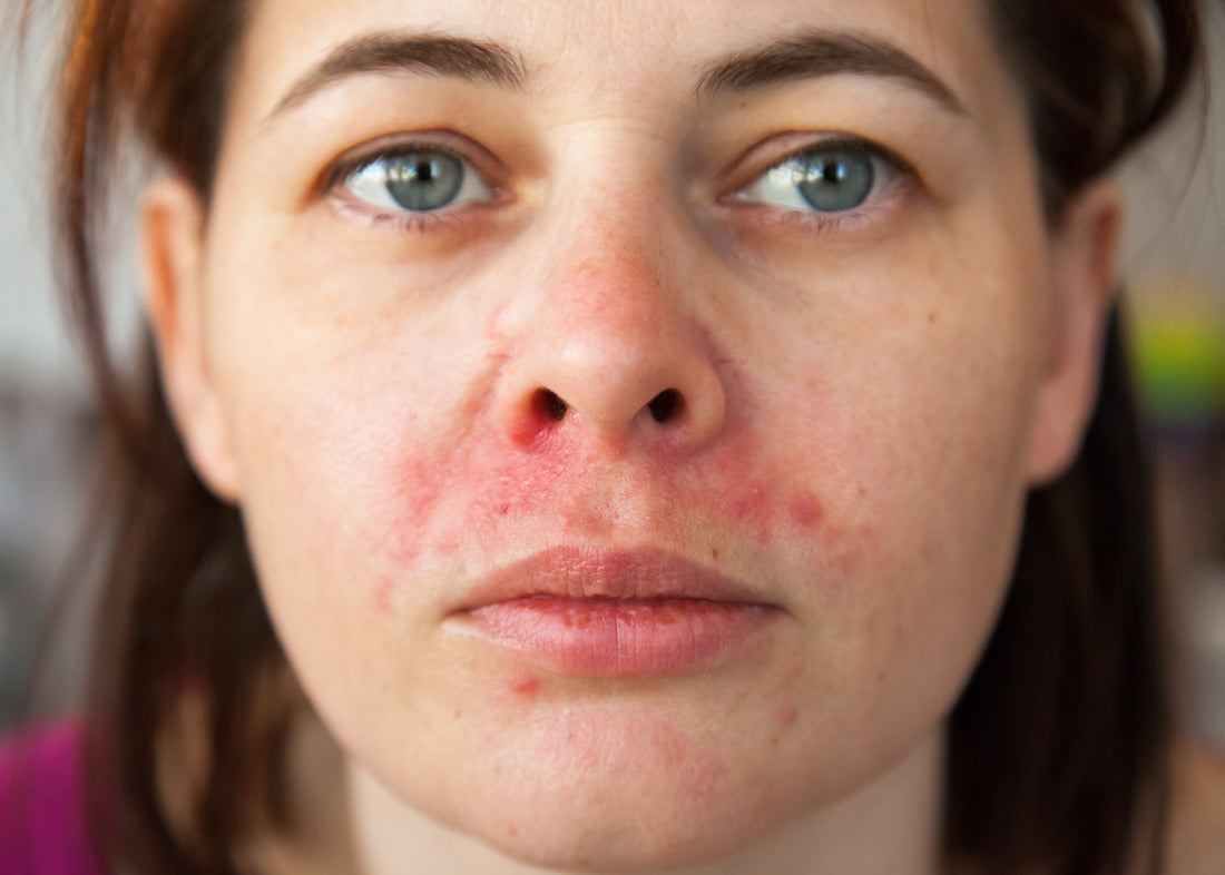 Sensitive Skin: What Causes It?