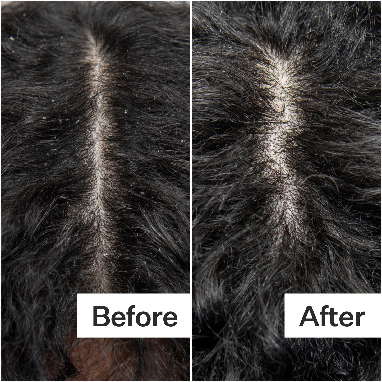 Act+Acre Cold Processed Scalp Detox