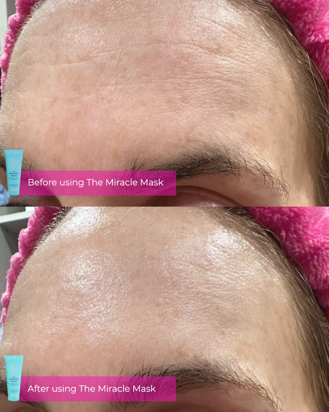 Ella & Jo Miracle Mask - Hydrating & Plumping