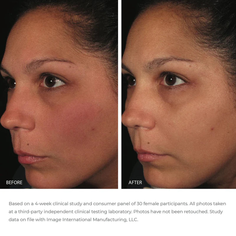 IMAGE Skincare Ormedic Balancing Antioxidant Serum
