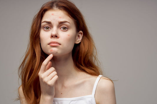 Why do you get spots before your period?