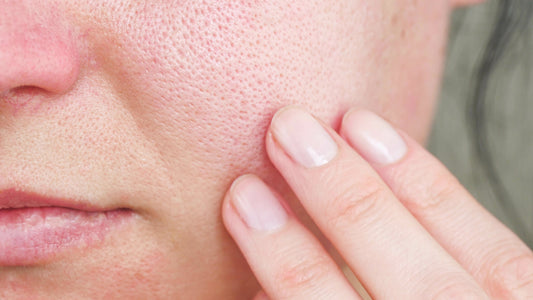 How To Calm Redness