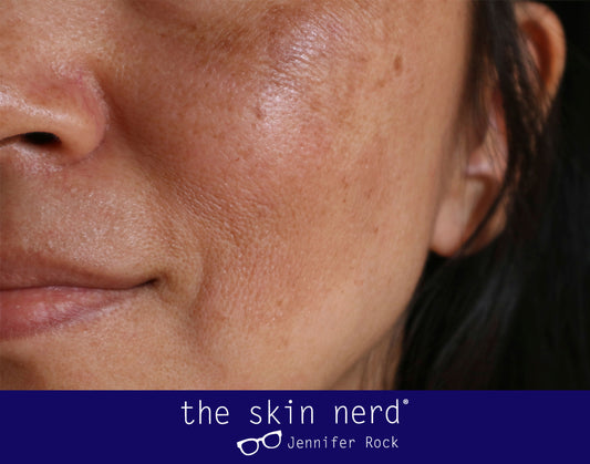 The Key Ingredients For Pigmentation (And The New Murad Product That Contains Lots of Them)