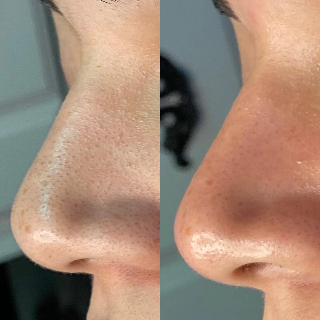 Reform Skincare Repair & Renew Gel