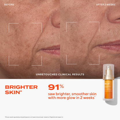 Murad Vita-C Glycolic Serum