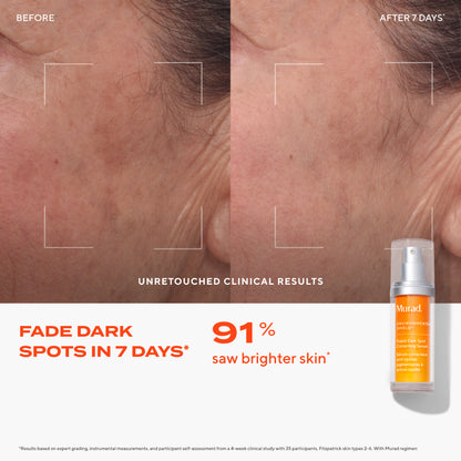 Murad Rapid Dark Spot Correcting Serum