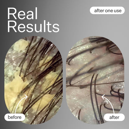 Act+Acre Cold Processed Hair Cleanse