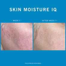 Load image into Gallery viewer, Advanced Nutrition Programme Skin Moisture IQ
